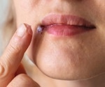 Breakthrough Cryo-EM Study Maps Herpes Replication Protein in New Detail