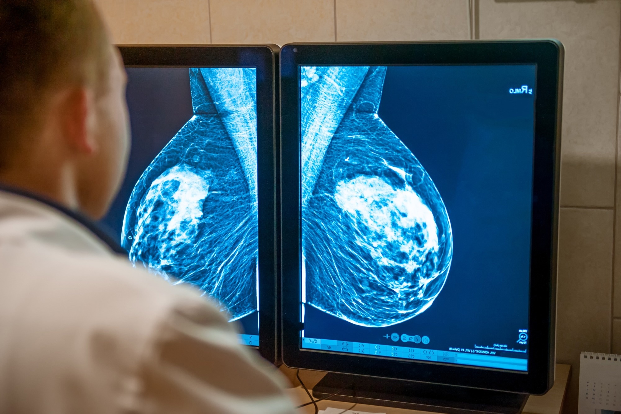 Study: Novel strategies for nanovaccine application in breast cancer treatment. Image Credit: Okrasiuk/Shutterstock.com Doctor examines mammogram snapshot of breast of female patient on the monitors.