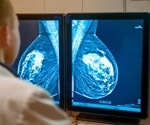 Scientists Reveal How Nanovaccines Boost the Immune Fight Against Aggressive Breast Cancers