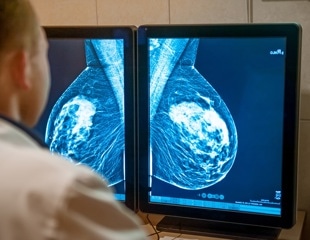 Scientists Reveal How Nanovaccines Boost the Immune Fight Against Aggressive Breast Cancers