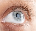 Retinal Implant Restores Sight for Patients With Macular Degeneration