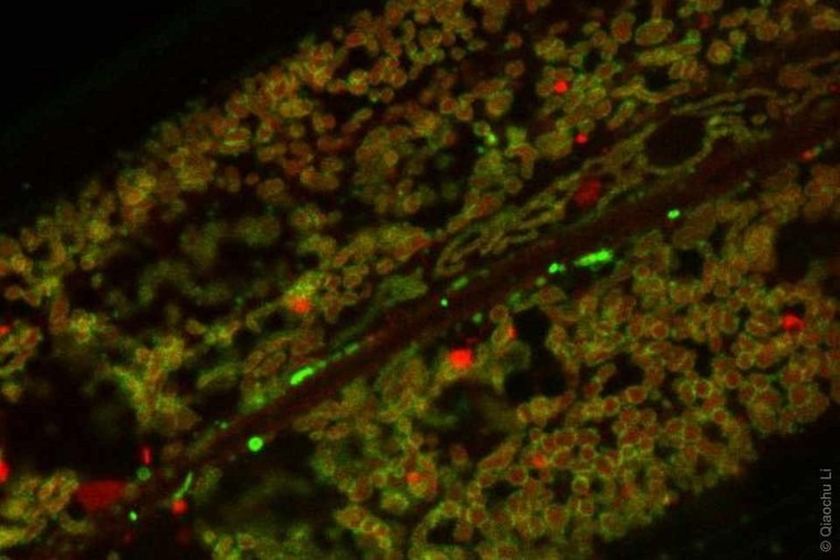 New Mechanism Links Leucine Levels to Improved Mitochondrial Performance