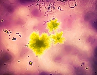 Hidden Role of Biliverdin Reductase A in Fighting Oxidative Damage