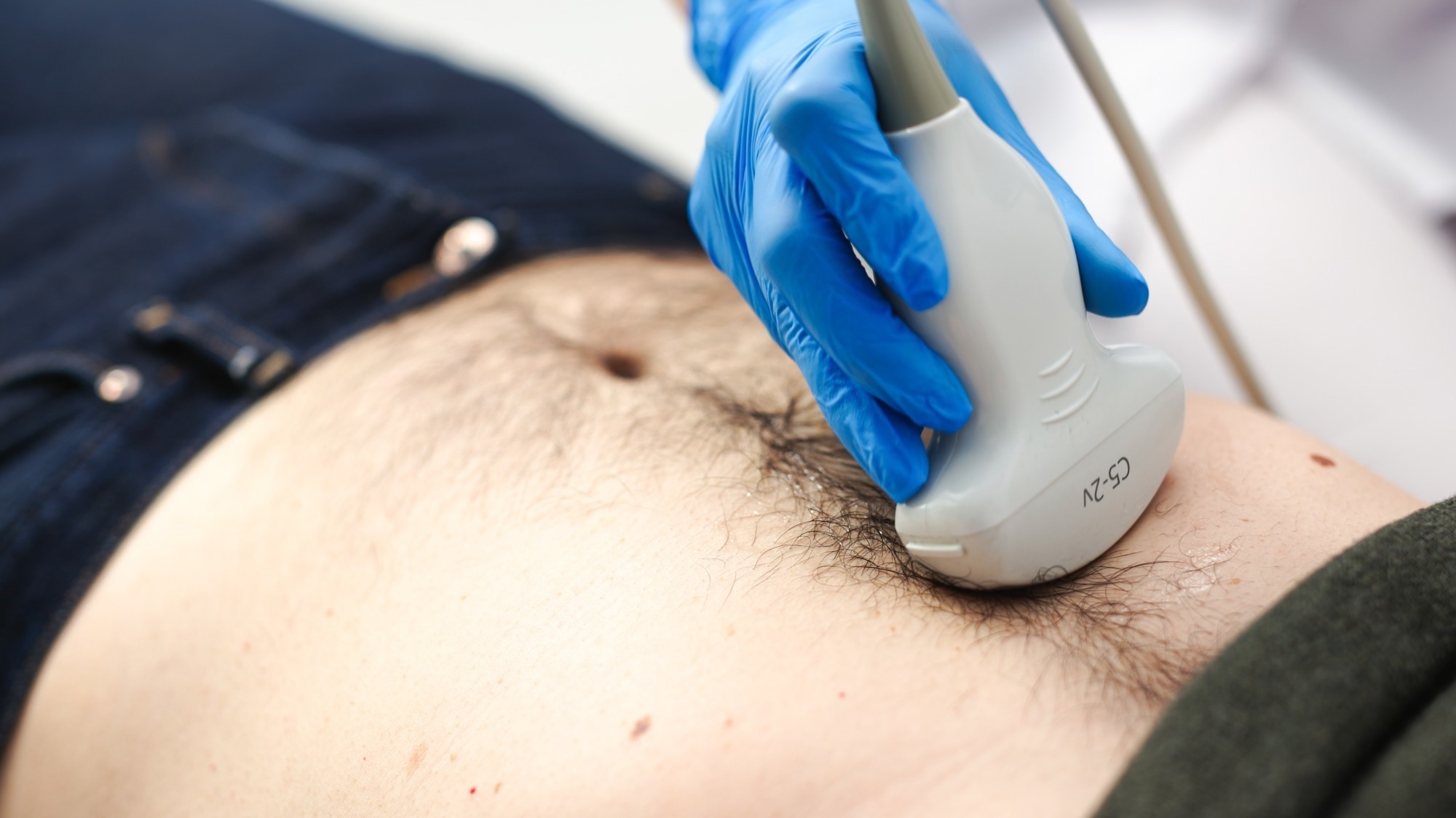 Ultrasound diagnosis of abdominal organs for a man in the clinic