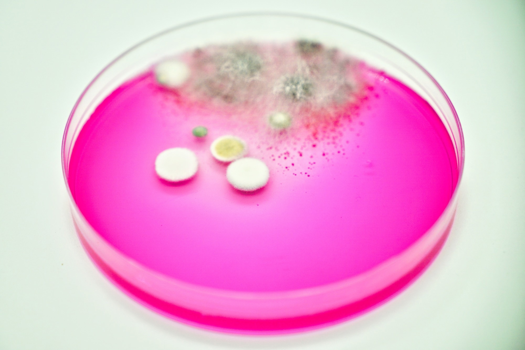 Petri dish with agar and fungi microorganism growth