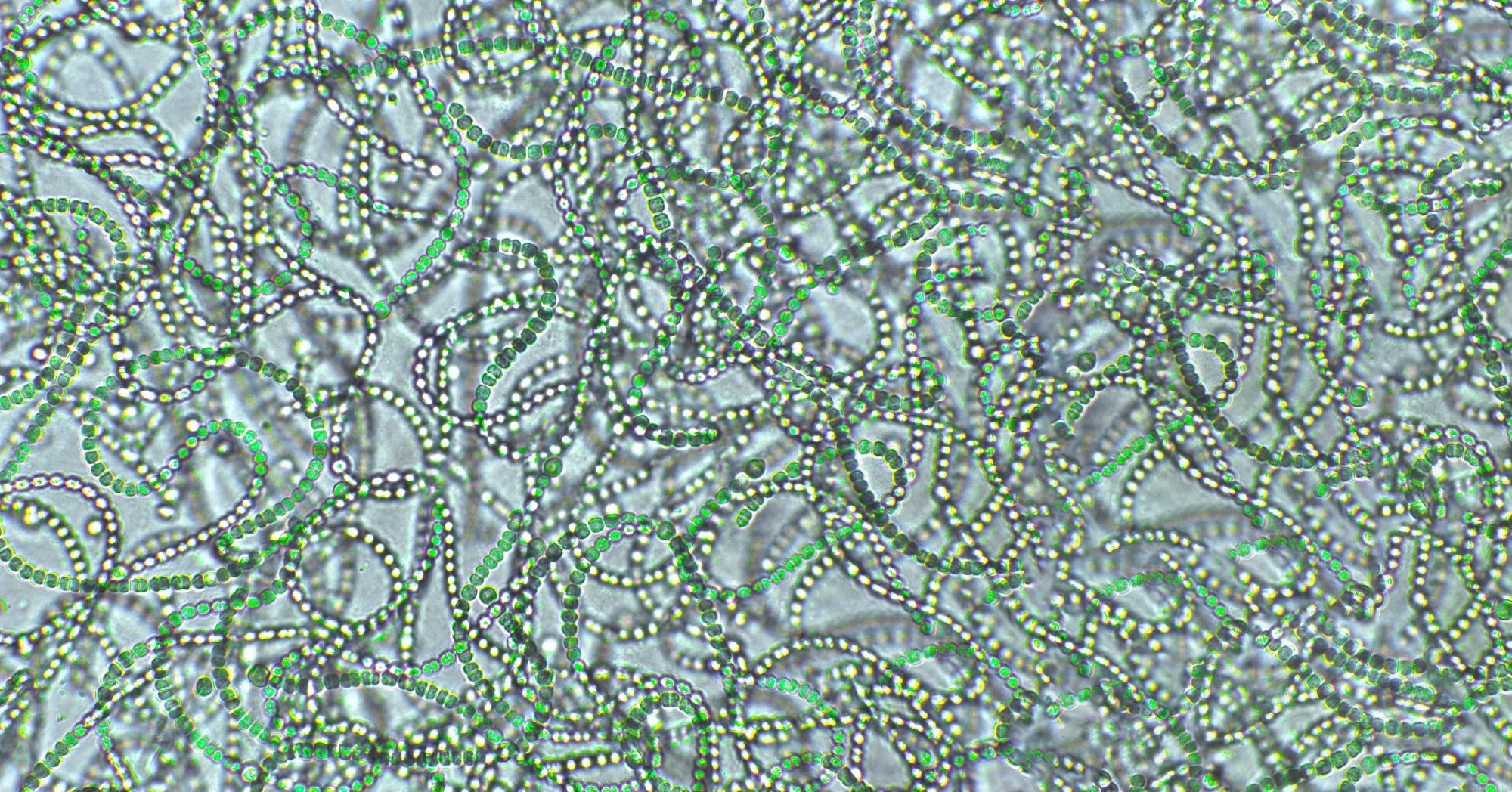 Nostoc sp. blue-green algae under microscopic view, cyanobacteria