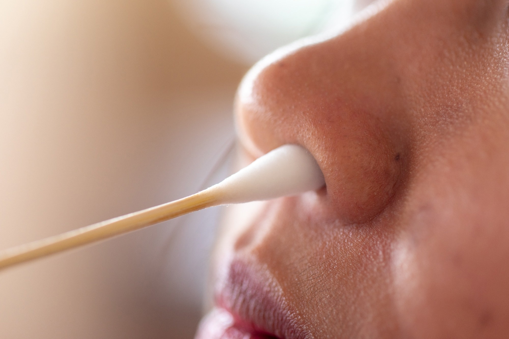 Swabbing for Bacteria (Staphylococcus aureus) in the human nose