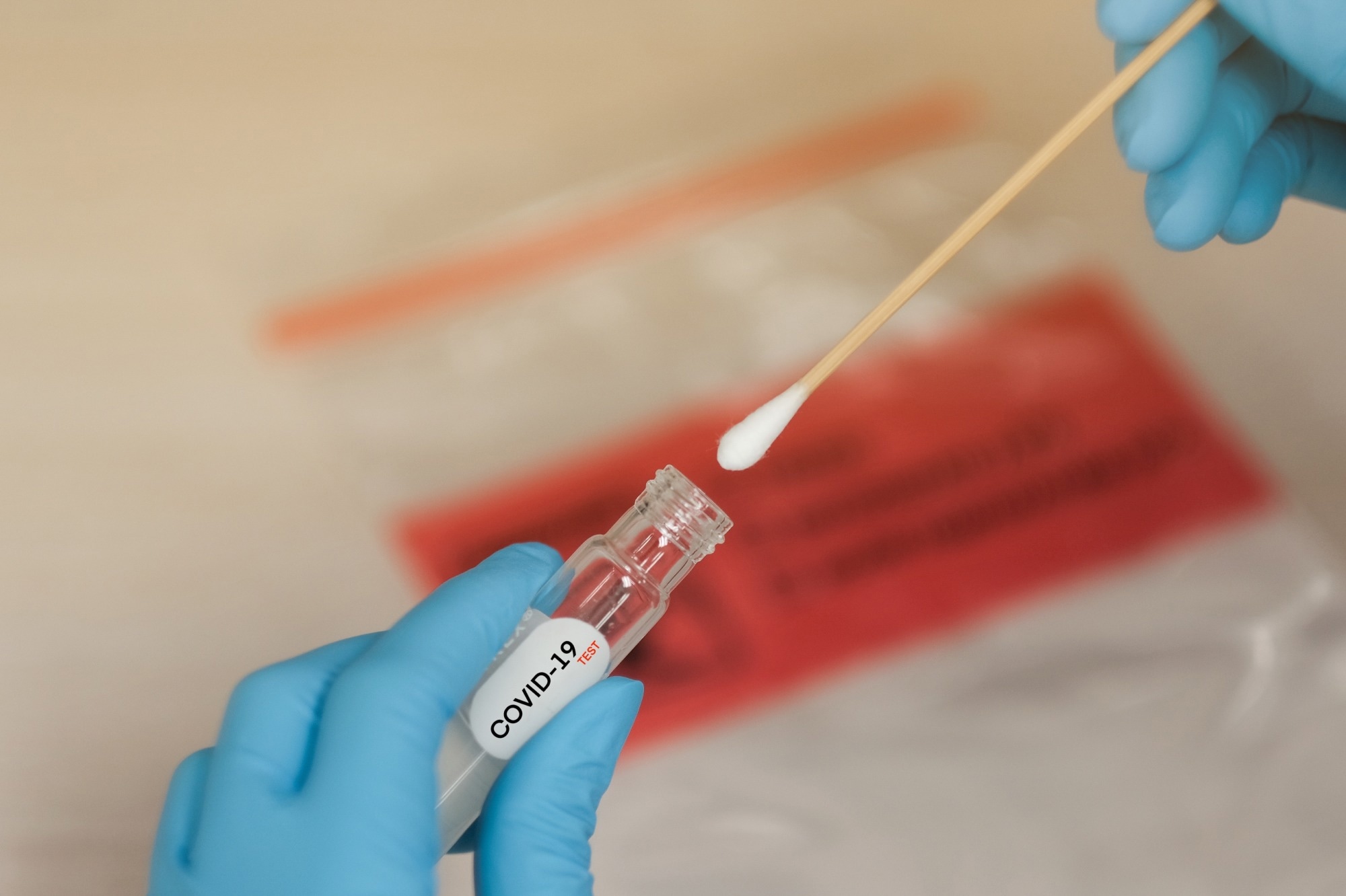covid-19, diagnostics