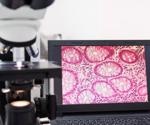 Cryo-EM Uncovers Hidden Complexity in Collagen Structure