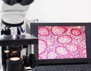 Novel Expansion Microscopy Technique for Detailed Plant Biomolecule Mapping