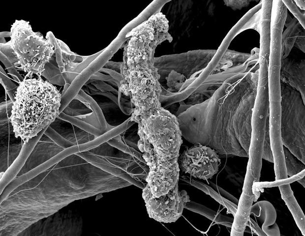 Ireland’s First BioBrillouin Microscope Arrives at Trinity College Dublin